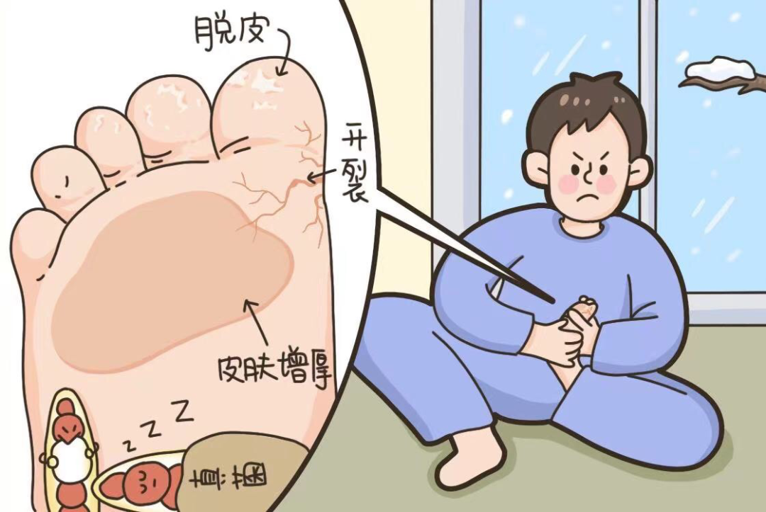 脚气脚臭漫画图片图片